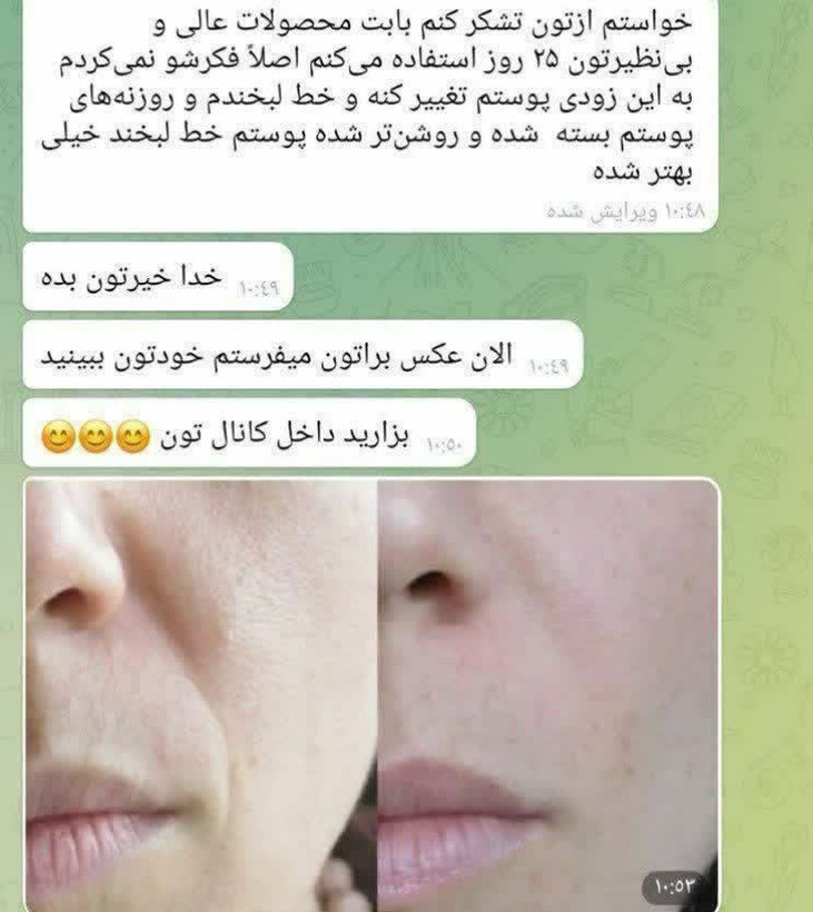 پک vip کرم جوانه گندم کاسهای ۱۸۰ میل