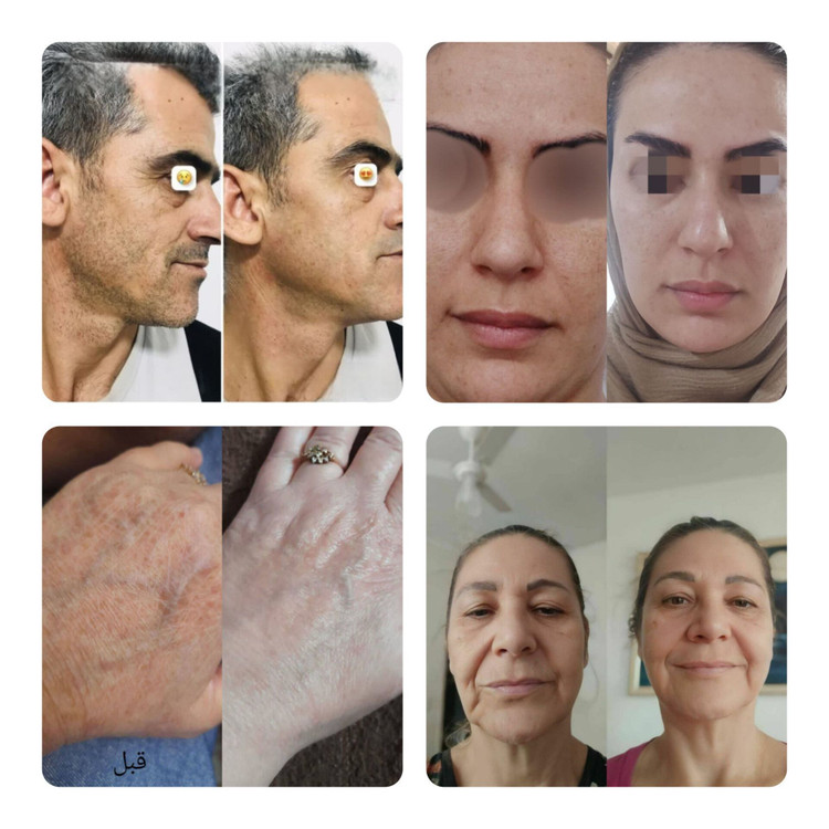 پک vip کرم جوانه گندم کاسهای ۱۸۰ میل